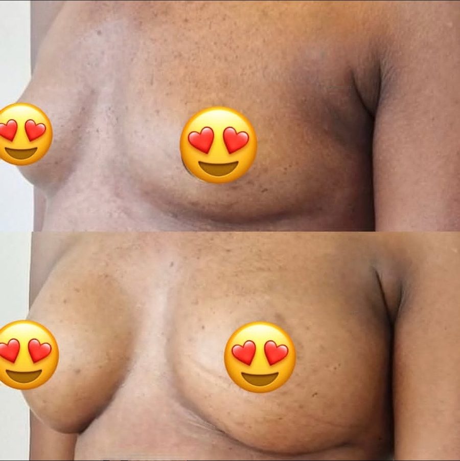Gift Breast Enlargement Tea photo 4