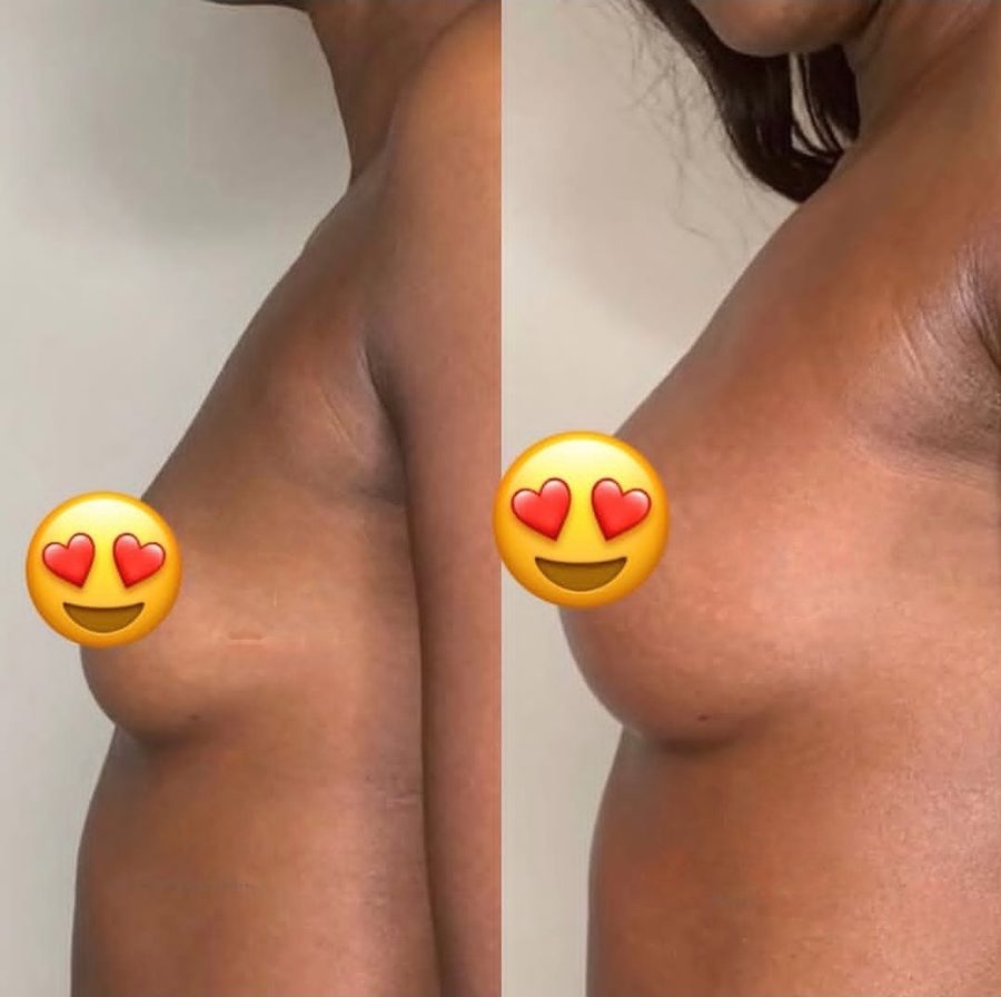 Gift Breast Enlargement Tea photo 5